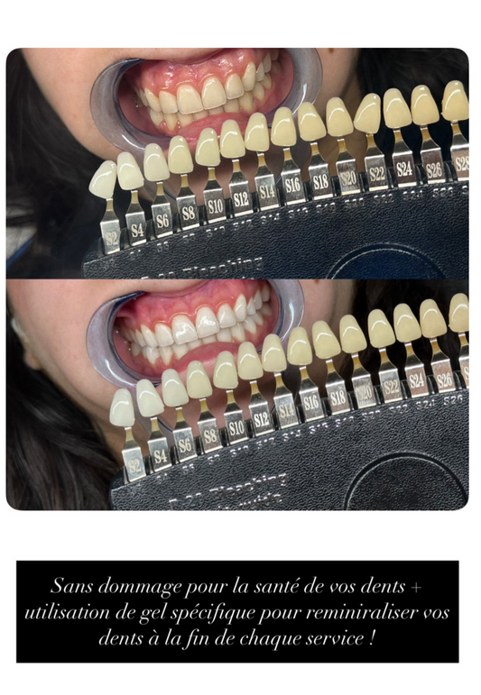 Gel blanchiment dentaire